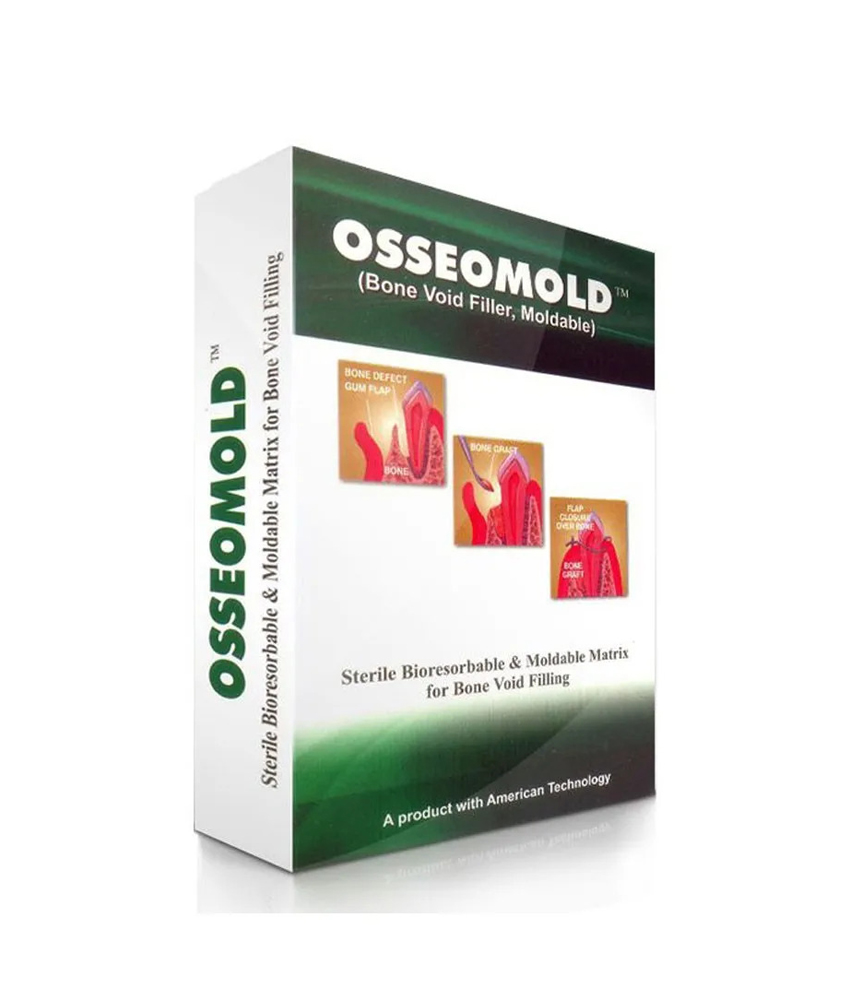 Advance Biotech Osseomould