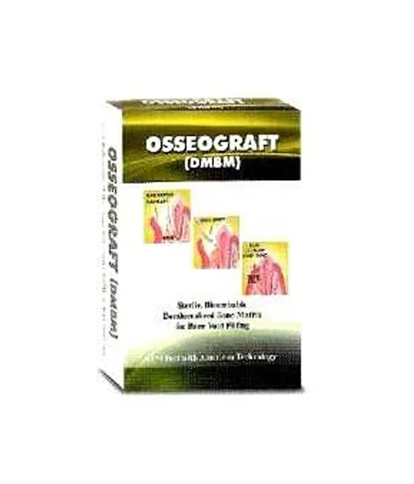 Advanced Biotech Osseograft DMBM