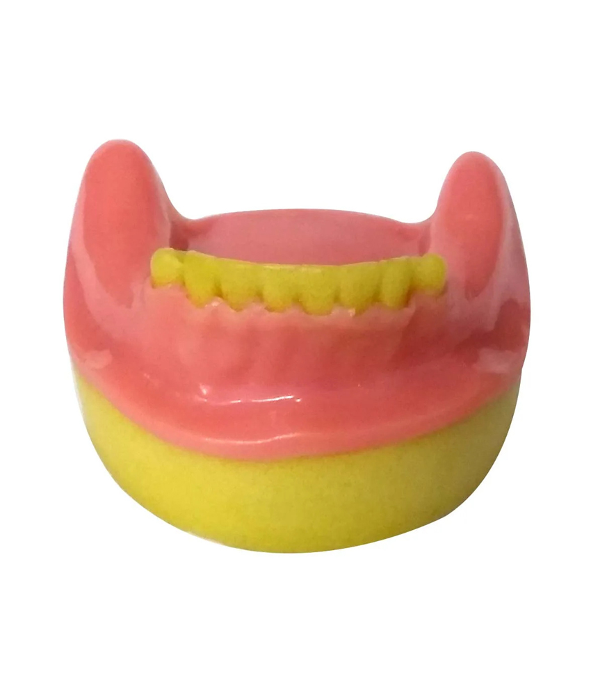 Dental Model Partially Edentulous Mandible MD-123