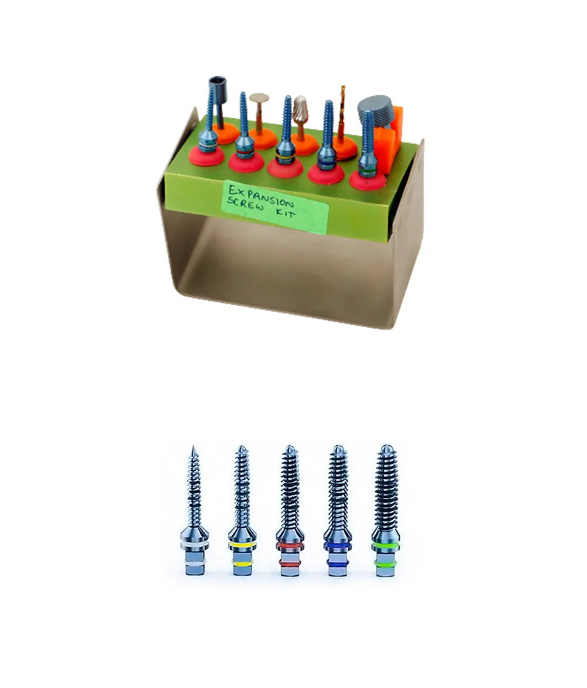 Julldent Bone Expansion Screws Set Refills