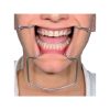 API Metallic Cheek Retractor