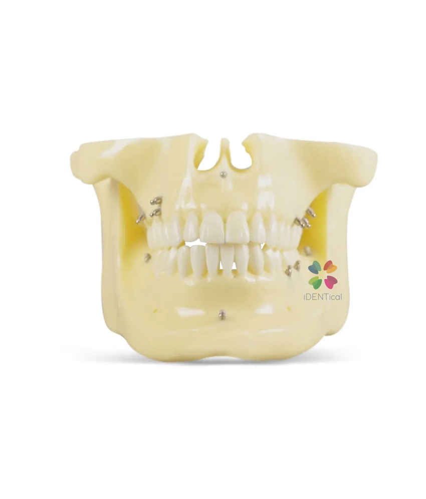 iDENTical Orthodontic Implant Model M2016