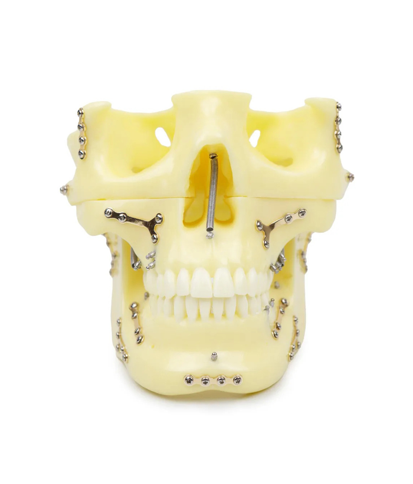 iDENTical Skull Education Model With Fracture And Restoration (M5004)